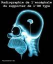 radiographie
